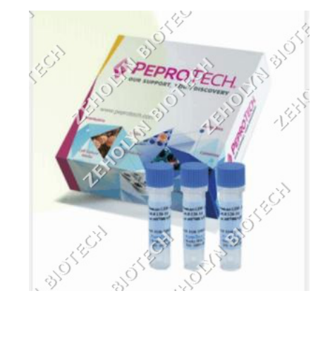 Recombinant Human PDGF-BB