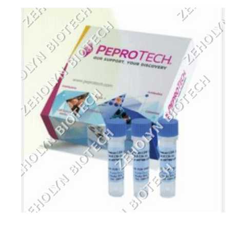 Recombinant Human CCL2/MCP-1