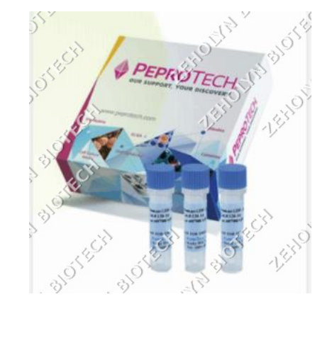 Recombinant Human CXCL8/IL-8